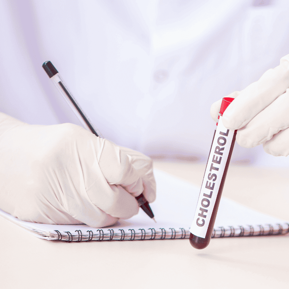 Paaugstināts holesterīns